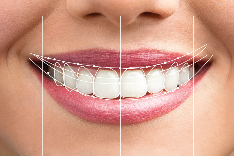 Smile example model