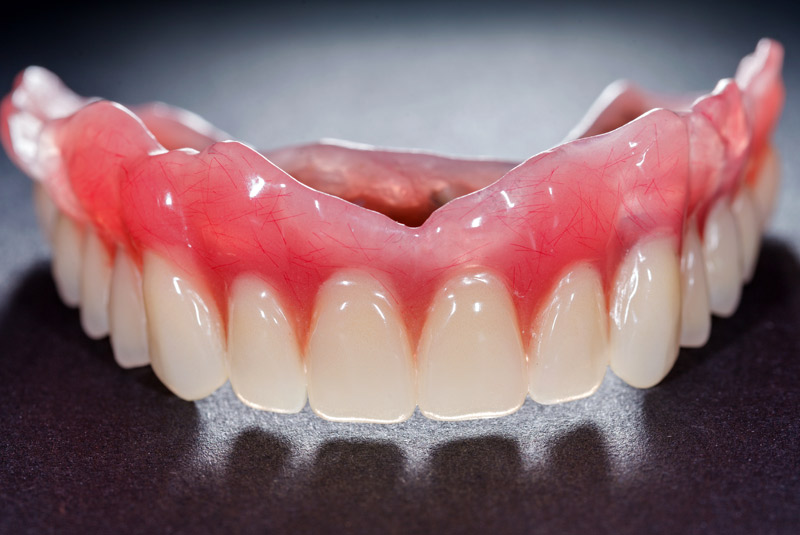 Denture example model