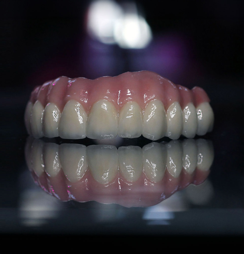 zirconia example model