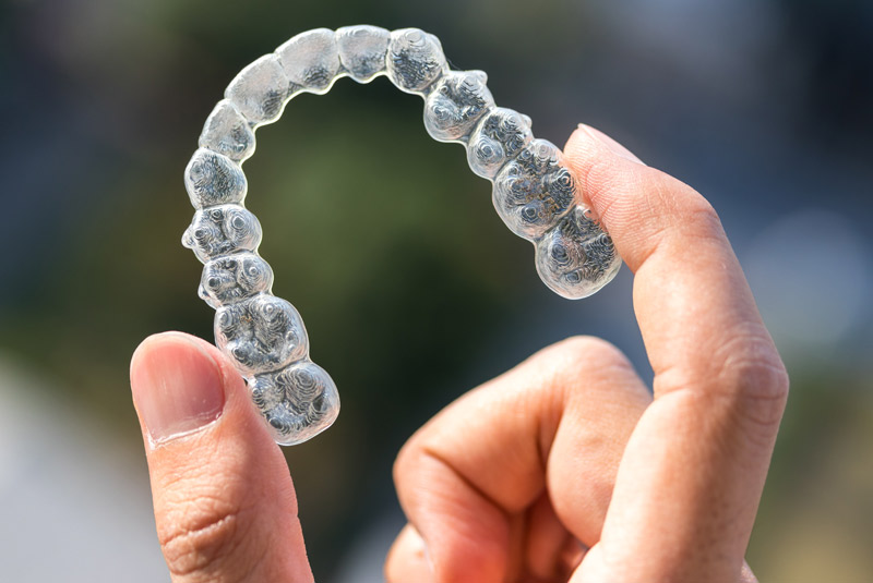 Invisalign example model