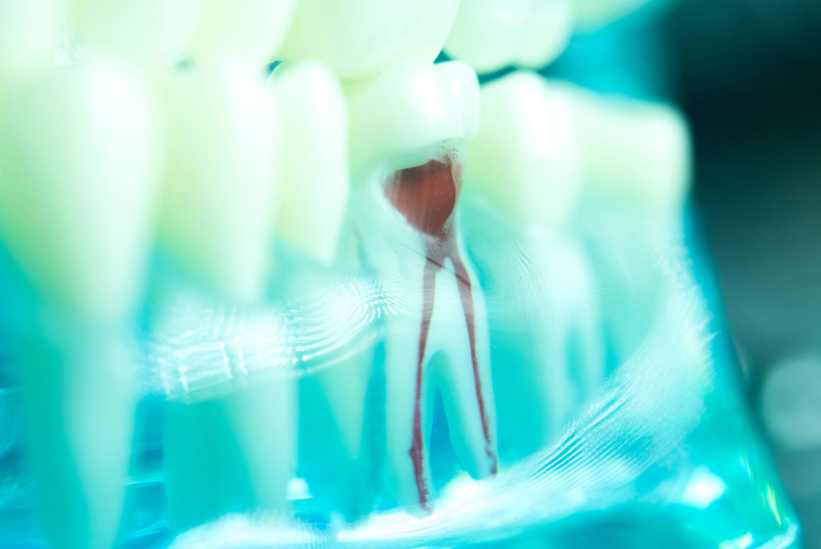 root canal model